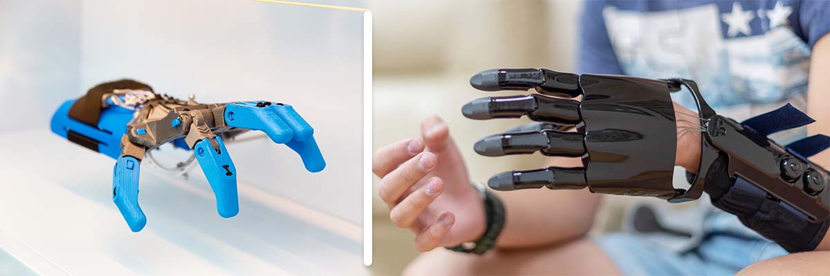 drukowanie protezy 3d druk